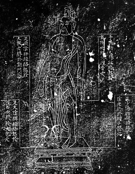 宋天圣铜人（宋代）