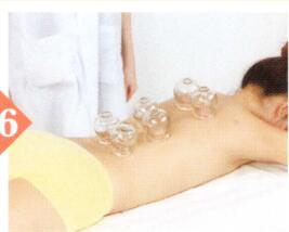 血瘀体质拔罐部位图解