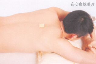 失眠艾灸哪个部位图解