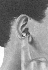 鼻炎按摩部位图解