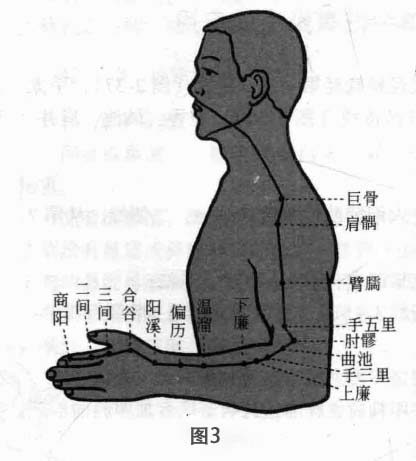 慢性单纯性鼻炎磁圆梅针疗法