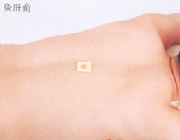 斑秃艾灸哪个部位图解