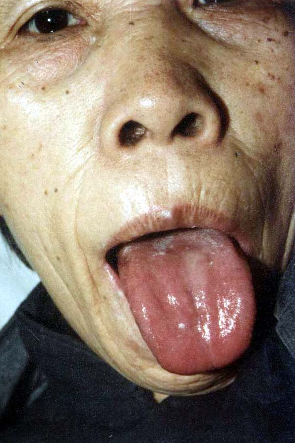 中医望目之目光有神