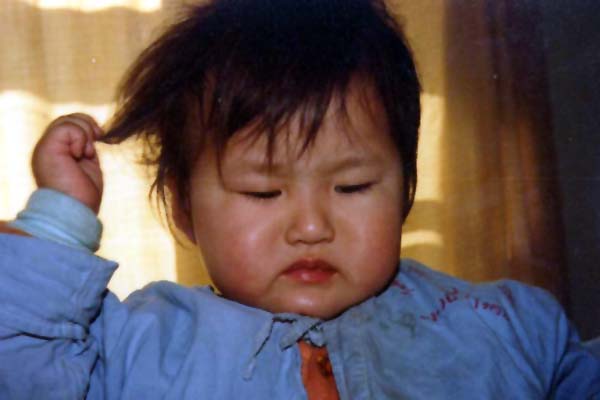 中医望口与唇之唇腮赤