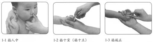 小儿发烧按摩部位图解
