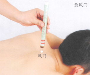 慢性支气管炎艾灸哪个部位图解