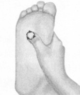 高脂血症按摩部位图解