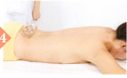 脱肛拔罐部位图解