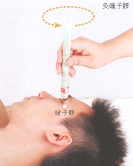 假性近视艾灸哪个部位图解