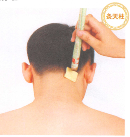 头痛艾灸哪个部位图解