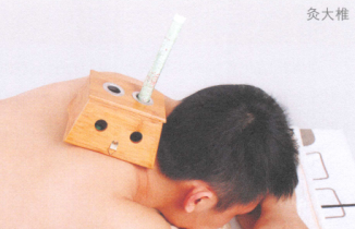 预防感冒艾灸哪个部位图解