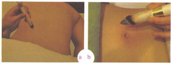 消除皱纹艾灸哪个部位图解