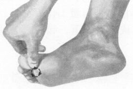 耳鸣-耳聋按摩部位图解