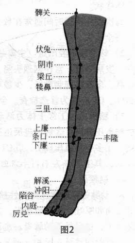 脑梗死后遗症磁圆梅针疗法