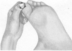 失眠症按摩部位图解