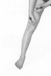 风湿病按摩部位图解