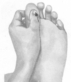 早泄按摩部位图解