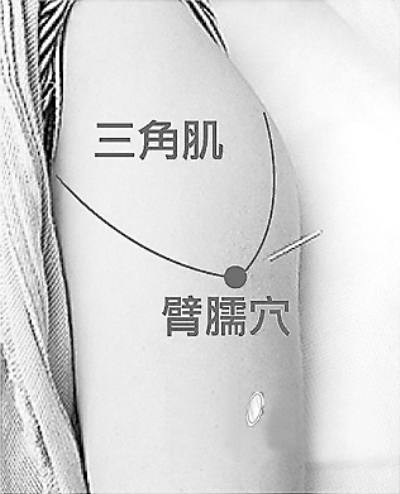 肩周炎的艾灸疗法