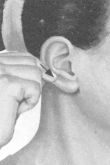 颈椎病按摩部位图解