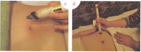 胃脘不适艾灸哪个部位图解