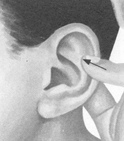 风湿病按摩部位图解