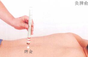 糖尿病艾灸哪个部位图解