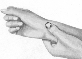 失眠症按摩部位图解