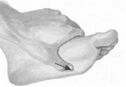 前列腺疾病按摩部位图解