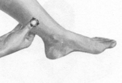 咽喉炎按摩部位图解