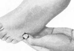 冠心病按摩部位图解