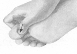 更年期综合征按摩部位图解