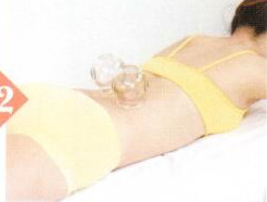 急性腰扭伤拔罐部位图解