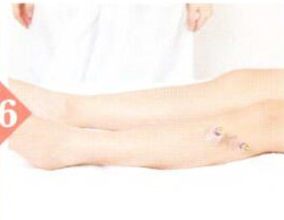 气虚体质拔罐部位图解