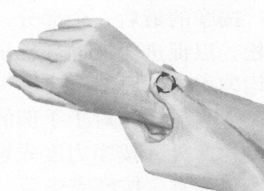 失眠症按摩部位图解