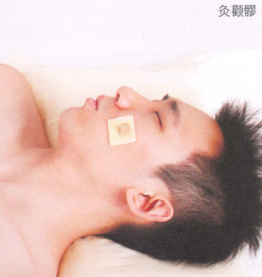 雀斑艾灸哪个部位图解