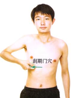 肝郁气滞型阳痿-早泄刮痧部位图解