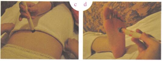 前列腺肥大艾灸哪个部位图解