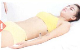 宣肺理气拔罐部位图解