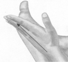 风湿病按摩部位图解