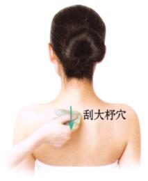 风湿性关节炎刮痧部位图解