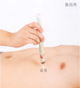 胆石症艾灸哪个部位图解