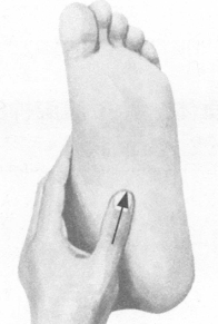 肩周炎按摩部位图解