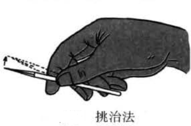 三棱针的操作方法