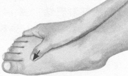 咽喉炎按摩部位图解