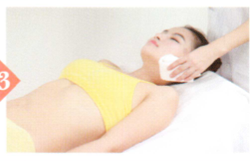 面神经麻痹拔罐部位图解