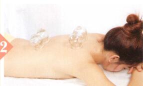 高血压拔罐部位图解