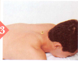 中暑艾灸哪个部位图解