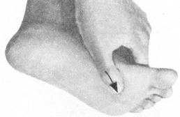 冠心病按摩部位图解