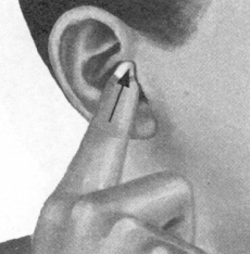 耳鸣-耳痛按摩部位图解