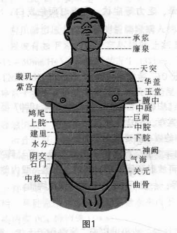 原发性痛经磁圆梅针疗法